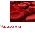 Thalassemia treatment in India