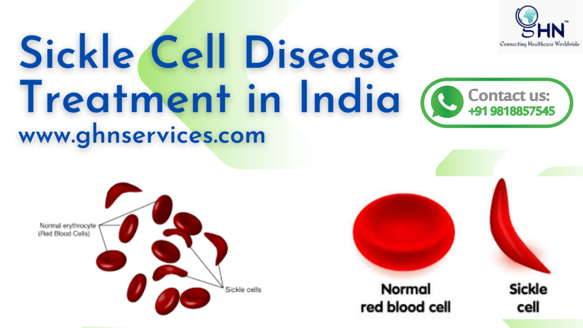 Best Sickle cell disease treatment in India