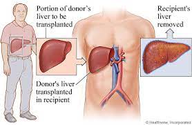 Best liver trasnplant hospitals in india