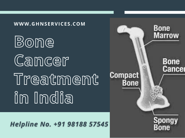 Bone Cancer Surgery cost in India